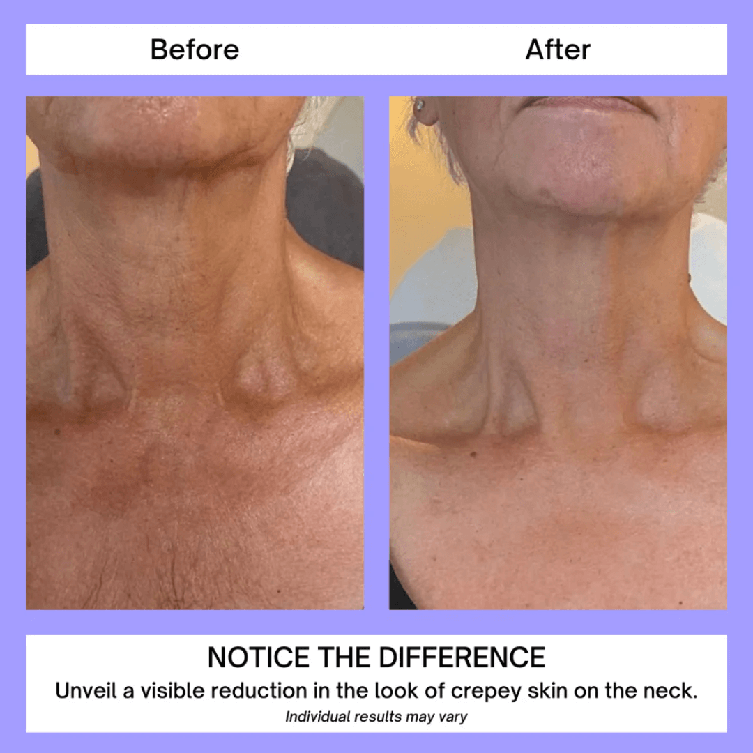 Neck Tightening & Lift Firming Magic Cream